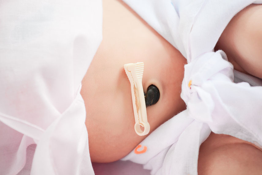 cordon-umbilical-bebe